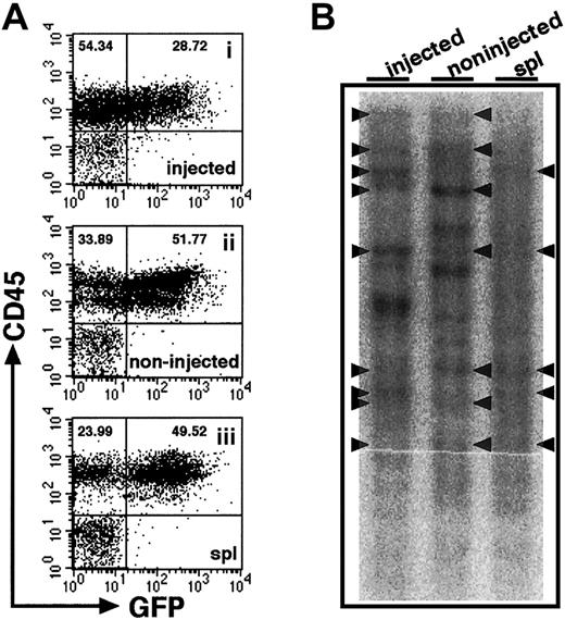 Fig. 5. Clonal analysis of iBM-injected SRCs. / (A) The proportion of EGFP+ human cells was analyzed at 8 weeks after iBM transplantation. Samples were obtained from injected side tibia (i), noninjected side tibia (ii), and spleen (iii). Cells were stained with antihuman CD45 mAb and analyzed by flow cytometry. Representative FACS profiles are shown from 4 independent experiments. The relative frequencies of each population are indicated. (B) Southern blot analysis for lentivirus integration sites. Genomic DNA extracted from samples indicated earlier was digested with EcoRI, which recognizes a unique site in lentivirus vector, and was hybridized with an EGFP probe. Each band represents a unique lentiviral integration site, and it corresponds to each clone. Arrowheads indicate common integration sites. Representative Southern blot analysis of 2 independent experiments is shown.