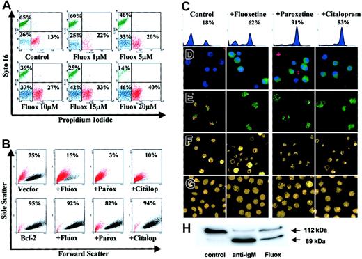 Fig. 2. Characteristics of SSRI-induced apoptosis in group I BL cells. / (A) L3055 cells treated with fluoxetine for 24 hours then double stained with syto 16 and PI for FACS analysis; percent cells viable (green), apoptotic (blue), and necrotic (red) are indicated. (B) L3055 transfected with either bcl-2, or empty vector treated for 24 hours with control medium, 20 μM fluoxetine, 20 μM paroxetine, or 100 μM citalopram, before analysis for forward versus side scatter. Percent viable cells remaining (black dots) are indicated; dead cells are in red. (C-E) L3055 cells were treated with SSRIs as for panel B. (C-D) Cells were treated for 6 hours and then stained for active caspases before analysis by (C) flow cytometry (percent cells active caspase positive indicated) or (D) confocal microscopy, counterstained with Hoechst nuclear dye (blue) and PI to detect dead and membrane-compromised cells (red) (activated caspases stain green). (E) Cells were treated for 24 hours, then stained with the cationic dye JC-1 for confocal microscopy. Mitochondrial depolarization is indicated by a shift from red to green fluorescence. (F) Cells were treated for 24 hours, then stained with the acridine orange for fluorescence microscopy. (G) Cells were treated as for panel F but using L3055 bcl-2-transfectants. (H) L3055 cells were cultured for 17 hours with either control medium, anti-μ chain antibody (anti-IgM, 10 μg/mL), or fluoxetine (20 μM); cell lysates prepared and equal amounts of protein (25 μg) resolved on 10% SDS-PAGE before blotting for PARP-1. The intact 112-kDa and cleaved 89-kDa protein are indicated by arrows. Each result is representative of at least 3 individual experiments.