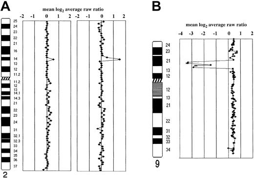 Fig. 2. Representative array CGH profiles of transformed FCL and FCL-derived cell lines. / Data are plotted as the mean log2 ratio of the triplicate spots for each clone normalized to the genome median log2ratio. The BAC and P1 clones covering individual chromosomes are shown. (A) Schematic representation of array CGH analysis on chromosome 2 in case IL116. A single-copy gain of a BAC clone in 2p16 containing theREL gene (log2 ratio + SD, 0.52 + 0.046) is shown in the FCL sample (on the left ideogram). In the posttransformed biopsy (on the right ideogram), amplification of the same gene locus (log2 ratio + SD, 1.13 + 0.027) is shown. (B) Homozygous deletion of P16 gene locus in 9p21 in triploid OZ cell line. Because this cell line contains a near-triploid karyotype, DNA copy number baseline is above the ratio 0.4 of the clones into 9p21, locus of the P16 gene, showed a log2 ratio lower than −2, indicating the presence of homozygous deletion sized approximately 5 Mb. FISH using a clone containing the gene confirmed the absence of copies ofP16 in the 3 aberrant chromosomes 9. The homozygous deletion had been reported in diploid OZ cell line using Southern blot analysis.25