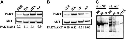 Fig. 6. Actions of recombinant HA and analbuminemic plasma on AKT. / (A-B) Western blot analysis of AKT activation. SER indicates serum; HA, human albumin; rHA, recombinant human albumin; NP, intact donor plasma; AP, analbuminemic plasma. (C) Polyacrylamide gel electrophoresis of NP and AP. Data representative of 3 experiments.