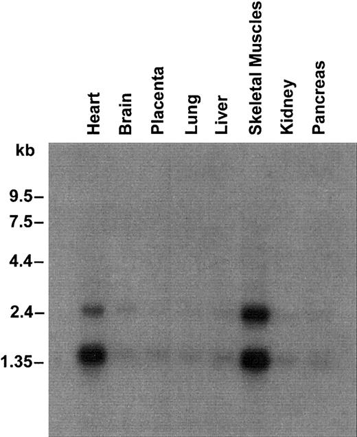 Fig. 2. Northern blot containing 2.5 μg poly(A) RNA from several human tissues. / Hybridization was performed with a 32P-labeled probe specific for UbcH5A coding sequence. Molecular sizes are shown on the left.