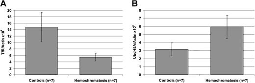 Fig. 4. Transferrin receptor (TfR) and UbcH5A mRNA expression normalized to actin mRNA levels in liver biopsy samples from 7 control subjects and 7 patients with untreated. / HFE-associated hemochromatosis. Panel A shows expression of transferrin receptor (TfR); panel B shows expression of UbcH5A mRNA. For expression analyses, a 2-step, real-time RT-PCR on the LightCycler system was used. TfR/actin and UbcH5A/actin ratios were calculated using LightCycler Relative Quantification Software Version 1.0 (Roche Molecular Biochemicals), which provides a fully automated, efficiency-corrected, relative quantification. Mean values are shown. The error bars represent 95% confidence intervals. The differences between TfR/actin and UbcH5A/actin ratios are statistically significant (P < .01 for TfR/actin ratio; P < .05 for UbcH5A/actin ratio).