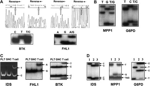 Fig. 1. Genotyping and expression of 5 X-chromosome exonic polymorphic genes. / (A) Genotype determination and sequence analysis of BTK andFHL1. Sequencing using reverse primers is shown. (B) Genotypes of MPP1 and G6PD. (C) FHL1and BTK are subject to X-chromosome inactivation. Clonal expression of IDS, FHL1, and BTK(shown here patients no. 38 and no. 37) was detected in platelets (PLT) and granulocytes (GNC); the weak upper band of IDSexpression in GNC was 3.35% of the major band, which is clearly outside the normal range,41 whereas T lymphocytes were polyclonal. (D) IDS, MPP1, and G6PDexpression patterns using SSCP analysis (the RNA mixture of PLT and GNC was used). Lanes 1 and 2, expression patterns of homozygosity inIDS, MPP1 and G6PD; lane 3, expression pattern of heterozygosity.