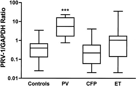Fig. 4. PRV-1 mRNA expression in granulocytes. / PV indicates polycythemia vera; CFP, congenital or familial polycythemia; ET, essential thrombocythemia. The boxes represent the interquartile range that contains 50% of values. The bars are lines that extend from the box to the highest and lowest values. A line across the box indicates the median. PRV-1/GAPDH expression ratio (calculated as 2ΔCT(GAPDH-PRV1)) was significantly increased in patients with PV (***P < .0001) when compared with Mann-Whitney nonparametric test to 33 healthy controls or CFP patients.