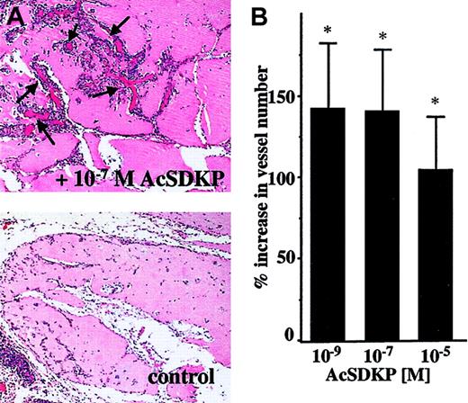 Fig. 5. AcSDKP-induced angiogenesis in Matrigel plugs. / Rats were injected subcutaneously with 0.5 mL Matrigel containing saline or AcSDKP. Matrigel plugs were removed after 7 days and processed for histology as described in “Materials and methods.” (A) A representative image of Matrigel plug sections containing saline or 10−7 M AcSDKP (original magnification × 10); arrows indicate newly formed vessels. (B) Vessel numbers were scored in 10 random fields (31.4 mm2 total) localized on the border of plugs. Data are the mean ± SEM of 3 individual experiments including 4 animals per condition in each experiment.
