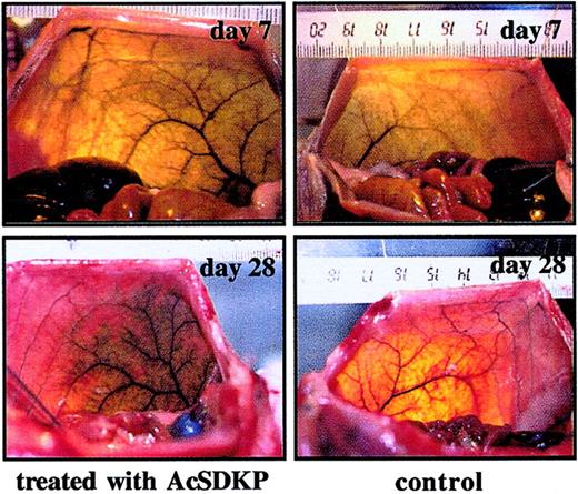 Fig. 6. Arteriography of rat ventrolateral abdominal wall performed 7 and 28 days after AcSDKP injection. / AcSDKP was injected into the abdominal wall of rats. Control injections were made with sterile saline. Animals were analyzed at day 7 and day 28 following first day of treatment. Bilateral angiography was obtained using India ink injection into the terminal aorta as described in “Materials and methods.” The markings on the ruler represent cm.