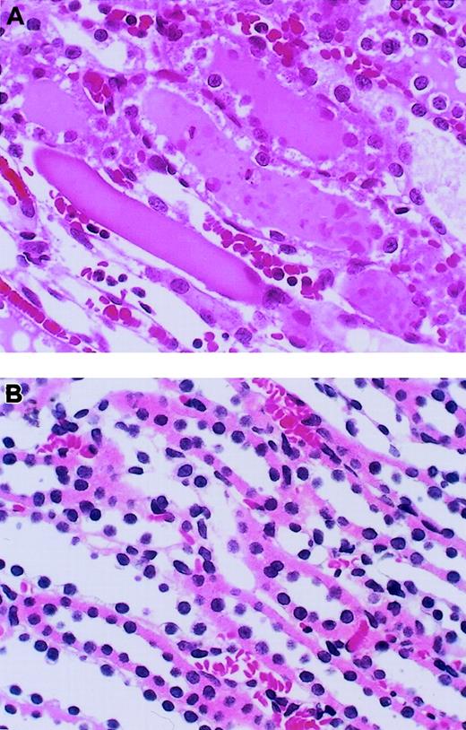 Fig. 3. Effect of antithrombin (AT) on renal histopathologic features of outer medulla in rats with ischemia/reperfusion (I/R) injury. / Tissues were obtained 24 hours after reperfusion. (A) Vehicle-treated group; (B) AT-treated group. Original magnification × 400 (hematoxylin-and-eosin stain). Typical results from each group are shown.