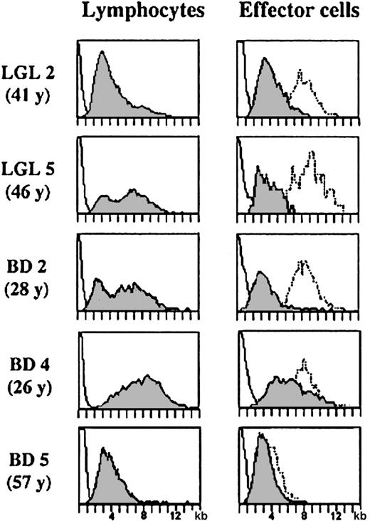 Fig. 3. Comparison of telomere length in lymphocytes and CD8+CD94+ effector T cells in TLGL leukemia patients and in lymphocytes and CD8+ effector cells in healthy blood donors. / Telomere length in lymphocytes (left panel) and in CD8+(CD94+) effector T cells (right panel) in the individuals with large expansions of TLGL cells (LGL 2, LGL 5, and BD 2) as well as in a young (BD 4, 26 years of age) and in an elderly (BD 5, 57 years of age) blood donor. For comparison, the telomere lengths in the monocytes (dotted line, right panel) of the same individual are shown.