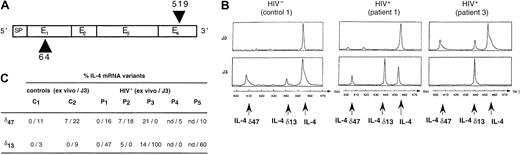 Fig. 3. Expression of IL-4 mRNA variant transcripts in PBMCs. / (A) Structure of the IL-4 mRNA (E indicates exon; SP, signal peptide) and positions of primers used for the generation of cDNA (arrows). (B) Identification of major IL-4 mRNA, and 42-bp and 13-bp deleted variants. IL-4 mRNA species were detected after hybridization of RT-PCR products with a fluorescent 5′ primer (Immunoscope assay). Profiles from a control donor and 2 HIV-infected patients, ex vivo (J0) or after 72-hour culture in medium (J3), are shown. (C) Relative representation of IL-4 mRNA variants in PBMCs from 2 healthy controls and 5 HIV+ patients.