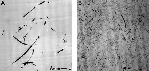 Fig. 5. Fibrin fibers in clots formed in the presence of elevated prothrombin levels are thinner and more densely packed than fibers from normal prothrombin levels. / Transmission electron micrograph of fibrin gel network from clots formed in the presence of 100% (A) and 300% (B) plasma prothrombin levels. Fibrin fibers were thicker and less dense in the presence of 100% prothrombin (A) and thinner and more densely packed in the presence of 300% prothrombin (B). Clots were formed in microtiter wells and fixed as described in “Materials and methods.” The fibrinogen concentration was 2 mg/mL. Original magnification × 10 000; bar 0.5 μm.
