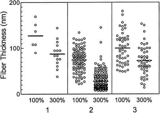 Fig. 6. Fibers in fibrin clots formed in the presence of elevated prothrombin are thinner than fibers formed in the presence of normal prothrombin levels. / Fibrin fibers in transmission electron micrographs of fibrin gel networks from clots formed in the presence of 100% and 300% plasma prothrombin levels were measured as described in “Materials and methods.” Three separate donors are depicted (1, 2, and 3). Differences in the mean thickness of fibrin fibers (horizontal lines for each data set) formed in the presence of 100% prothrombin illustrate the platelet donor-dependent differences observed in the assays.3233 However, clots formed in the presence of 300% prothrombin were consistently composed of thinner fibers than clots formed in the presence of normal prothrombin levels (P < .0215).