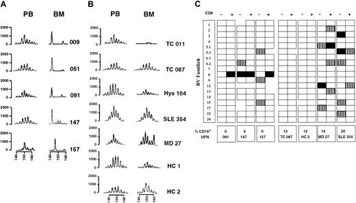 Fig. 1. T-cell–receptor diversity of bone marrow–derived lymphocytes in thymoma patients. / (A) CDR3 heterogeneity length analysis of β variable 8 (BV8) families of T cells isolated from peripheral blood and bone marrow (PB and BM, respectively) of 5 patients with thymoma and B lymphopenia. In the cases of patients 091, 147, and 157, we refer to CD8+ T cells. Profiles for patients 051 and 009 have been generated from unfractionated T cells. (B) BV8 profiles of 2 patients with thymoma and normal B-cell counts (TC 011 and TC 087, respectively), 3 patients with thymoma-unrelated diseases (His 104, SLE 354, and MD27), and 2 healthy donors (HC 1 and HC 2). All profiles in panel C refer to CD8+ T cells, except for TC 011, His 104, and HC 1, in which data were generated on unsorted T cells. PCR products were separated on DNA sequencing polyacrylamide gel by using an automated ABI PRISM 377 apparatus (Perkin Elmer, Applied Biosystems, Warrington, United Kingdom). Band intensity and size were evaluated with the Gene Scan software (Perkin Elmer) and expressed as relative fluorescence units (rfu) and base pairs (bp). (C) Synopsis of TCR repertoire expressed in bone marrow–derived CD8+ and CD8− T-cell subsets. Open, gridded, and filled boxes, respectively, represent BV families showing 3 standard profiles: normal (Gaussian distribution), altered (< 5 peaks with a non-Gaussian distribution), and mono-oligoclonal profile (< 3 major peaks). The absence of boxes represents undetectable BV families.