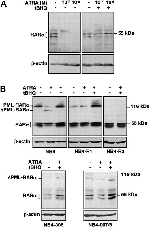 Fig. 7. Protection of RARα and PML-RARα from ATRA-induced degradation by SERCA inhibition in ATRA-sensitive and ATRA-resistant cells. / (A) ATRA-sensitive wild-type HL-60 cells were treated for one day with vehicle, ATRA alone at concentrations indicated on the top of the figure, or with 3 μM tBHQ alone or in combination with ATRA; and RARα protein was detected by immunoblotting using the C-20 antibody. Immunoblotting of the same samples for β-actin was used as an internal control. (B) ATRA-sensitive wild-type NB4, as well as ATRA-resistant primed NB4-R1, NB4-R2, NB4-306, and NB4-007/6 cells were treated for one day with vehicle, 10−7 M ATRA (not shown for NB4-R2 and NB4-306 cells), or with a combination of 8 μM tBHQ and 10−7 M ATRA; and RARα, as well as PML-RARα protein was detected by immunoblotting using the RPαF′ antibody. Immunoblotting of the same samples for β-actin was used as an internal control. ΔPML-RARα corresponds to the degradation products of PML-RARα. Numbers on the right side correspond to the apparent molecular weight of the proteins in kDa. Western blots were performed 3 times.