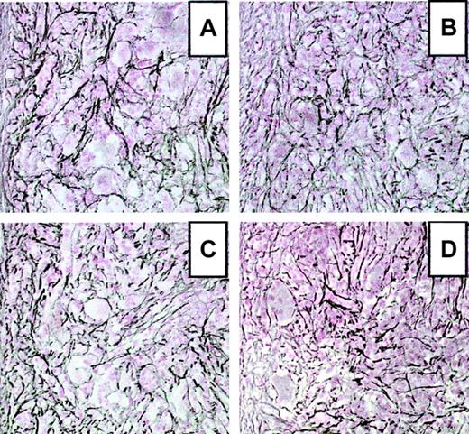 Fig. 3. Development of myelofibrosis in the spleen of TPO-overexpressing mice. / Representative spleen sections from WT andopg−/− hosts hematologically repopulated with TPO virus–infected BM cells from WT or opg−/−donors at 3 months after transplantation. Sections were stained according to Gordon-Sweet to reveal reticulin fiber deposition. (A) WT host engrafted with WT BM cells. (B) opg−/−host engrafted with opg−/− BM cells. (C) WT host engrafted with opg−/− BM cells. (D)opg−/− host engrafted with WT BM cells. Sections show severe accumulation of reticulin fibers in the 4 experimental groups. Original magnification for all panels, × 200.