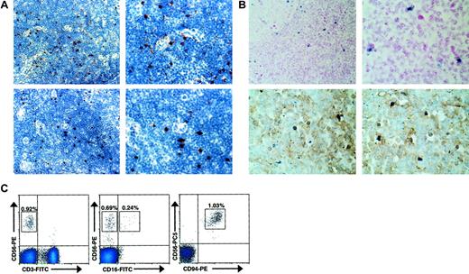 Fig. 1. CD56bright NK cells are present in human lymph nodes. / (A) CD56+ and CD94+ lymphocytes are present in the paracortical T-cell areas of normal human lymph nodes. Low-power (× 40, left) and high-power (× 100, right) photomicrographs of normal human lymph nodes stained for CD56 (top panels) and CD94 (bottom panels). Results are representative of 2 reactive lymph nodes. (B) CD56+CD3− lymphocytes were observed in the parafollicular T-cell areas of human lymph nodes. Low-power (× 40, left) and high-power (× 100, right) photomicrographs of normal human lymph nodes evaluated for CD56 expression using in situ RT-PCR (top panels). High-power photomicrographs of similar sections from lymph nodes colabeled with anti-CD3 mAb and CD56 via in situ PCR demonstrating that the CD56+ cells lack CD3 expression (bottom panels). Results are representative of at least 4 different experiments. (C) Distinct populations of CD56brightCD3− NK cells were observed via flow cytometry in normal human lymph nodes. Flow cytometric density plots are shown gated on lymphocytes stained with mAbs reactive to CD56 and CD3 (left), CD56 and CD16 (middle), and CD56 and CD94 (right). Percentage of lymphocytes in each boxed region is shown. Results are representative of 3 independent experiments on at least 3 normal human lymph nodes.