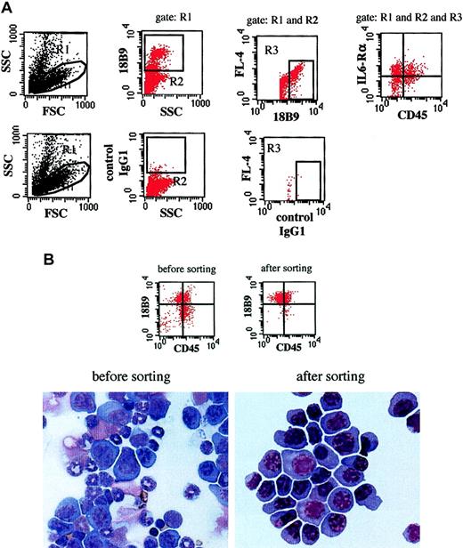 Fig. 1. Gating, sorting, and microscopic examination of 5T2MM cells. / (A) Gating of 5T2MM cells. Cell debris was excluded by a lymphoblastoid gate (R1) on an FSC/SSC dot plot. 5T2MM idiotype (18B9)+ cells were defined within a live gate (R2) on an SSC/18B9 dot plot. Autofluoresence was excluded on an 18B9/FL-4 dot plot. No marker was used in the FL-4 channel. 5T2MM cell phenotype was then analyzed on an FL1/FL2 dot plot. Upper panels are dot plots from a bone marrow sample labeled with CD45-FITC, IL-6Rα–PE, and 18B9 with rat-antimouse-PerCP as a secondary reagent. Lower panels are from the same sample stained with isotype-matched control antibody. (B) Sorting and microscopic examination of 5T2MM cells. Dot plots illustrate expression pattern of 5T2MM idiotype (18B9) and CD45 on a bone marrow sample before and after sorting. Photographs below illustrate May-Grünwald-Giemsa–stained cytospin of same sample before and after sorting. These data were obtained from a mouse with 0.57 g/dL paraprotein concentration and 40% of its 5T2MM cells CD45+. After sorting, myeloma purity of 97% was obtained, as analyzed by flow cytometry. Microscopic examination of the cytospin indicated a purity of 99%. Original magnification × 400.