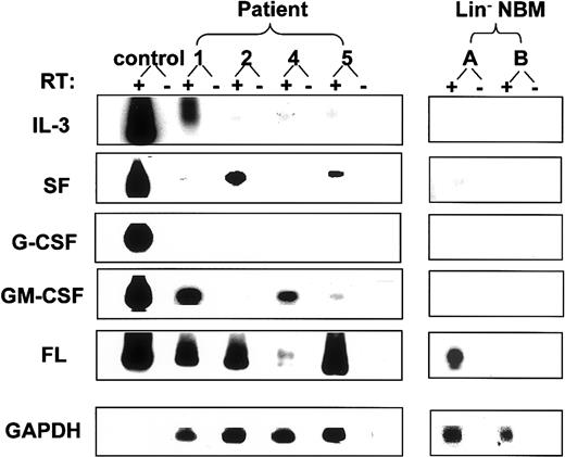Fig. 3. Growth factor mRNA expression in AML blasts and normal bone marrow cells. / RT-PCR was performed with total cDNA synthesized from 10 000 AML blasts or NBM cells using a specific primer set for each growth factor as described in “Patients, materials, and methods.” Southern blots of PCR products were hybridized with the corresponding cytokine-specific probes. For each cytokine, the positive control was a cDNA from a murine cell line transfected with the corresponding human cytokine cDNA.