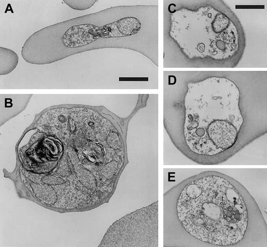 Fig. 5. Ultrastructure of. / P falciparum in CC cells. Parasite clone GB4 was cultured for 4 days in CC cells and then observed by electron microscopy. Healthy forms (ring, A; schizont, B) and degraded forms (C-E) are shown for comparison. Parasite death is associated with disintegration of parasite membranes, organelles, and nuclei, as well as the absence of knobs. Bars represent 1 μm.