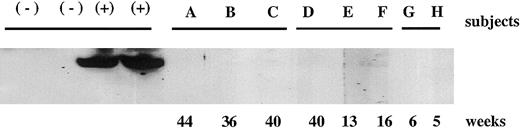 Fig. 1. Western blot for detection of antibodies to human F.IX in subjects in study. / Serum samples were collected at monthly intervals from all subjects and used in a 1:1000 dilution as the primary antibody in an immunoblot to detect antibodies to human F.IX. Shown here are samples from each subject, drawn at a series of time points ranging from 5 weeks to 44 weeks after vector injection. The positive control (+) is performed using serum from a patient with an inhibitor (24 BU) to F.IX and the negative control is serum from a healthy subject.