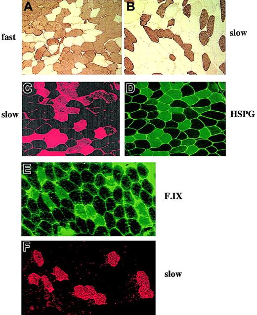 Fig. 4. Histochemical analysis of human vastus lateralis muscle and vector transduction. / (A-B) Immunohistochemical stain for fast-twitch (A) and slow-twitch (B) isoforms of myosin. (C-D) Simultaneous immunofluorescence stain for slow-twitch myosin (C) and HSPG (D) indicates cytoplasmic HSPG stain in slow-twitch muscle fibers. (E-F) Colocalization of F.IX transgene expression (E) and slow-twitch muscle fibers (F) on serial sections of biopsy from subject G, 2 months after vector administration. Original magnification × 100 for panels A-F.