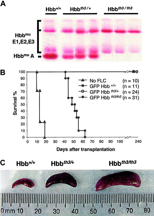 Fig. 1. Establishment of an adult model of β0-thalassemia. / (A) Cellulose acetate analysis showing the hemoglobin patterns in ED 14.5 Hbb+/+, Hbbth3/+, and Hbbth3/th3 embryos. E1, E2, and E3 indicate the 3 embryonic hemoglobins. (B) Mice engrafted with Hbbth3/th3 hematopoietic FLCs die 6 to 9 weeks after receiving transplants. Donor FLCs harvested from ED 14.5 embryos were injected in irradiated C57BL/6 recipient mice. Mice engrafted with Hbbth3/th3 FLCs died or had to be killed 7 to 9 weeks after receiving transplants. Recipients of Hbb+/+ and Hbbth3/+ FLCs survived for at least 8 months (duration of follow-up). (C) Spleen sizes in mice engrafted with Hbb+/+, Hbbth3/+, and Hbbth3/th3 FLCs at 6 to 8 weeks after receiving transplants.