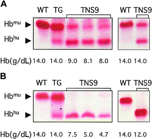 Fig. 5. Hb analysis in TNS9-rescued mice. / Cellulose acetate electrophoresis of peripheral blood lysates was performed monthly. Hb levels (g/dL) are indicated at the bottom of each lane. Hbmu indicates mouse Hb tetramer; Hbhu, Hb tetramer composed of mouse α and human β chains; WT, wild-type mouse, showing Hb single; and TG, transgenic mouse blood,91015 showing hemoglobin tetramers that incorporate human βA (Hbbhu, 14% of total Hb). TNS9: 4 TNS9-transduced Hbbth3/th3 FLCs mice (3 on one gel on the left and one on another gel to the right) 8 weeks (A) and 4 months (B) after transplantation.
