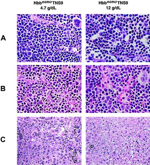 Fig. 6. Histopathologic analysis of hematopoietic tissues in long-term TNS9-treated chimeras. / Left: 4.7 g/dL Hb, 8 months after transplantation. Right: 12.0 g/dL Hb, 6 months after transplantation. (A) Bone marrow (original magnification, × 60). Left: There is still a relative increase in the erythroid lineage but with more evidence of maturation than in untreated chimeras (Figure 3). Myeloid maturation is seen. Right: Normal erythroid maturation is present; the erythroid precursors are not as densely packed. Myeloid maturation, still decreased compared with normal, is more frequently seen than in the mouse with the lower Hb level (left). (B) Spleen (original magnification, × 60). Left: There is more maturation and less degenerative changes in the erythroid lineage than in the untreated mice (Figure 3B, right). Right: In comparison to the mouse with lower Hb level, the sinuses appear to be somewhat less compressed. The sinusoidal erythroid cells are more eosinophilic, suggesting better hemoglobinization. The nuclei are not as irregular as in either the mouse with lower Hb levels (left) or in the Hbbth3/th3 chimera. (C) Liver (original magnification, × 20). Left: Residual EMH, greater than in control Hbbth3/+ chimeras (Figure 3C, center) and approaching that of the Hbbth3/th3 chimeras (Figure 3C, left). Right: Minimal residual EMH, considerably less than in the Hbbth3/+ controls (Figure 3C, center). Stain: hematoxylin and eosin. Hepatic iron deposition, as detected by a Gomori iron stain: the 4.7 g/dL Hb chimera was similar to the Hbbth3/+ chimera (Figure 3D; center) and was minimal in the 12.0 g/dL Hb chimera (data not shown).