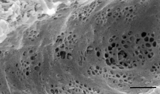 Fig. 1. Scanning electron micrograph of the liver sieve, demonstrating fenestrations clustered into liver sieve plates. The scale bar indicates 1 μm.