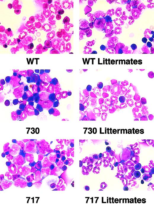 Fig. 4. Morphology of bone marrow cells in Tg mice. / Myeloid cells at various stages of differentiation were observed in bone marrow of wild-type (WT) G-CSFR Tg mice and littermates. In contrast, immature myeloid cells were prominent in truncation-mutant Tg mouse marrow. Original magnification × 1000; May-Grünwald-Giemsa stain.