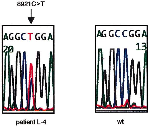 Fig. 1. Missense nucleotide change of. / ATM gene at 8921C>T in L-4. The heterozygous missense nucleotide change at 8921C>T in exon 64 in L-4 is shown. The arrow indicates the position of the nucleotide change. The first codon of the ORF was designated +1 (GenBank no.U33841).