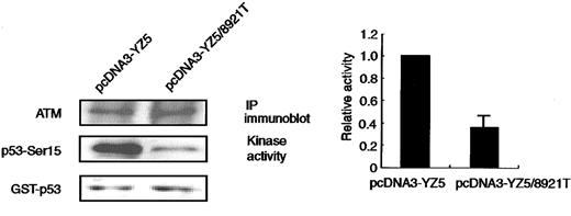Fig. 3. In vitro phosphorylation of p53-Ser15 by immunoprecipitated ATM. / The catalytic activity of ATM protein immunoprecipitated with anti-FLAG antibody from 293 cells transiently transfected with pcDNA3-YZ5 or pcDNA3-YZ5/8921T was assayed in vitro against the GST-p53 (amino acids 1-100) substrate. Kinase reactions were Western blotted and tested with an anti-p53–Ser15 phosphospecific antibody, or with an anti-ATM antibody, to verify the amount of immunoprecipitated ATM protein per lane. Equal amounts of GST-p53 were loaded. Representative data from 3 independent experiments are shown (left panel). Phosphorylation of recombinant GST-p53 (amino acids 1-100) by pcDNA3-YZ5/8921T was standardized for kinase activity of pcDNA3-YZ5 (= 1), and was shown as fold increase. Data were expressed as the mean (± SE) of 3 independent experiments (right panel).