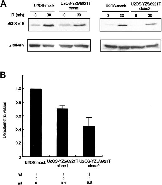 Fig. 4. Dominant-negative effect on p53-Ser15 phosphorylation in U2OS transfectants. / (A) Western blot analysis of p53-Ser15 phosphorylation after X-IR in clone 1 (left panel) and clone 2 (right panel). Cells were harvested at 0 and 30 minutes after 5-Gy X-IR and analyzed by Western blotting with anti-p53–Ser15 phosphospecific antibody. α-Tubulin was used as a control for protein loading. (B) Fold decrease of p53-Ser15 phosphorylation in clone 1 and clone 2, standardized for the level in irradiated/nonirradiated U2OS-mock (= 1.00). Data were expressed as the mean (± SE) of 2 independent experiments. U2OS cells were transfected with vector alone or pcDNA3-YZ5/8921T. Two independent clones (1 and 2) were isolated and analyzed for expression of wild-type and mutant ATM mRNA by RT-PCR/RFLP analysis using theAlwNI restriction site specific for the 8921T mutation. Clones 1 and 2 expressed wild-type and mutant ATM at a ratio of 1:0.1 and1:0.8, respectively.