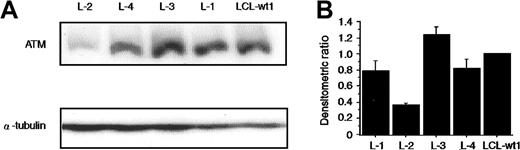 Fig. 6. Normal expression of ATM protein in L-4. / (A) The levels of ATM protein present in the lysates from the indicated cell lines were determined by Western blotting using anti-ATM antibody32 and normalization with an α-tubulin antibody. Lanes 1 to 4 are LCLs from patients L-2, L-4, L-3, and L-1, respectively. Lane 5 is a normal control LCL (LCL-wt1). (B) The histograms were obtained by the densitometric analysis of the Western blot autoradiographs, after correction of each lane for α-tubulin content. Values are normalized to those of the normal control LCL-wt (= 1). Although not shown, ATM protein levels in L-5, L-6, and L-7 were comparable to those of LCL-wt1 and of another control (LCL-wt2). Data were expressed as the mean (± SE) of 3 independent experiments.