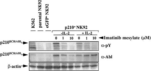 Fig. 4. p210-transduced cells express. / BCR/ABL, and imatinib mesylate inhibits p210BCR/ABL phosphorylation. Parental (untransduced), eGFP+, and p210-eGFP-transduced (p210+) NK92 cells (5 × 104 cells) were incubated with or without imatinib mesylate for 48 hours in the presence or absence of IL-2 and analyzed by Western blot with antiphosphotyrosine (α-pY) or anti-Abl antibody. Cells treated with imatinib mesylate demonstrate a dose-dependent inhibition of p210BCR/ABL phosphorylation, both in the presence and absence of IL-2. p210BCR/ABLexpression is present in all p210-transduced NK92 and K562 (positive control) cells.