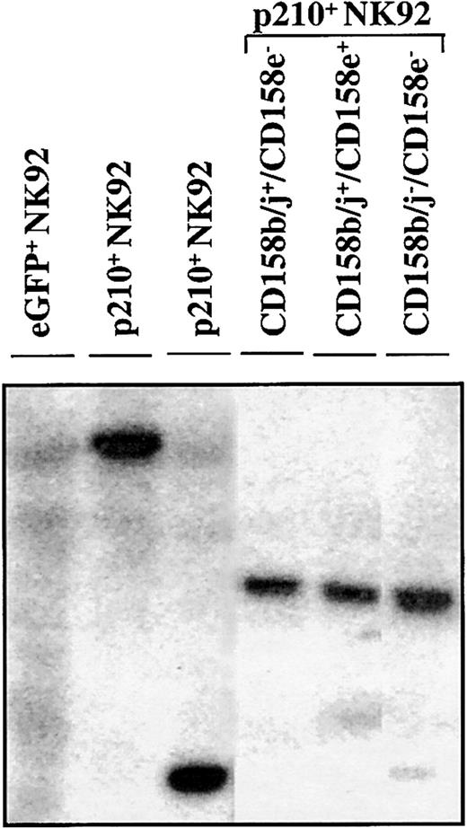 Fig. 7. KIR expressing p210+ NK92 cells derive from the same clone. / In a Southern blot analysis, genomic DNA from parental, eGFP+, and p210-eGFP+(p210+) NK92 cells was digested withEcoRI, electrophoresed on a 0.7% agarose gel, and probed with a 32P-eGFP probe. Representative lanes show that CD158b/j+/CD158e− (lane 4), CD158b/j+/CD158e+ (lane 5), and CD158b/j−/CD158e− (lane 6) p210+NK92 cell populations express identical dominant bands, indicating that they derive from the same clone. KIR-negative eGFP+ NK92 cells show a smear (lane 1), and 2 different p210+ clones show a different unique band (lanes 2-3).