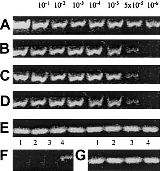 Fig. 5. CD detection by RT-PCR. / (A) Amplification of human CD56 in the prepared dilutions of CD56+ cells in SP2/0-Ag14 myeloma mouse cell line. (B) Amplification of human CD161 in the same prepared dilutions. (C) Amplification of human CD34 in the prepared dilutions of CD34+ in SP2/0-Ag14 myeloma mouse cell line. (D) Amplification of human CD7 in the prepared dilutions of CD56+ cells. (E) Amplification of β-actin to monitor the integrity of the mRNA of the samples A-D. (F) Detection of CD mRNA in UCB/CD14+ cells: lane 1, CD56; lane 2, CD161; lane 3, CD34; and lane 4, CD7. Identical results from 4 conducted experiments. (G) Amplification of β-actin of the samples in panel F.