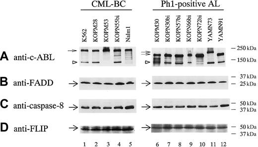 Fig. 7. Western blot analysis of molecules consisting of DISC in Ph1-positive leukemia cell lines. / Lysates from 12 Ph1-positive leukemia cell lines were analyzed by Western blot using antibodies against c-ABL kinase domain, FADD, caspase-8, and FLIP as described in “Materials and methods.” Small arrows and arrowheads indicate BCR-ABL proteins (p210, p203, and p190) and c-ABL protein, respectively, in panel A. Large arrows indicate FADD in panel B, caspase-8 in panel C, and FLIP in panel D.