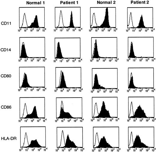 Fig. 7. Comparable expression of maturation markers between CML-DCs and DCs derived from healthy volunteers. / Immature DCs derived from healthy individuals (normals 1 and 2) and from CML patients (patients 1 and 2) were incubated with mAbs specific for the molecules indicated (black histograms) and with isotype-matched mAbs (white histograms). Cell surface expression was measured by flow cytometry. The results are representative of 10 experiments obtained with DCs derived from different patients as indicated in Table1.