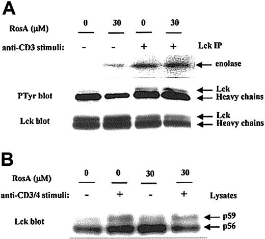 Fig. 4. Lck kinase activity is not inhibited by RosA. / (A) The effect of RosA on TCR-induced activation of Lck kinase activity. Lck was immunoprecipitated by anti-Lck mAb (5 μg/mL) from Jurkat cell lysates and analyzed for its ability to phosphorylate enolase (top panel). Lck kinase assay was performed as described in “Materials and methods.” Autophosphorylation status (middle panel) and equivalent immunoprecipitation of Lck (bottom panel) was confirmed by Western blotting using antiphosphotyrosine antibody and anti-Lck mAb (1 μg/mL), respectively. (B) The effect of RosA on OKT3/4-induced Lck activation. After preincubation with or without RosA, Jurkat cells were harvested and activated with OKT3/4 for 2 minutes. Jurkat cell lysates (2 × 106 cells per lane) were subjected to 12% SDS-PAGE, transferred to the nitrocellulose membrane, and blotted with anti-Lck mAb (1 μg/mL). Lck isoforms p56 and p59 are indicated by arrows. Results are representative of 2 separate experiments.