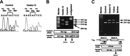 Fig. 2. Identification of the genetic defect responsible for Osaka-12. / (A) Nucleotide sequence analysis of αIIb cDNA from Osaka-12. Platelet αIIb mRNA was amplified by RT-PCR. Nucleotide sequence of the amplified fragments was determined by using Taq DyeDeoxy Terminator Cycle Sequencing kit and an ABI 373A DNA sequencer. (B) Allele-specific restriction enzyme analysis of αIIb cDNA. The region around exon 4 of the αIIb mRNA was amplified by PCR, followed by digestion with ScaI. ScaI digestion of the PCR products yielded 517-bp, 264-bp, and 316-bp fragments in the healthy allele. The T>C substitution abolished one of the restriction sites forScaI. Resultant fragments were electrophoresed in a 1.5% agarose gel. Marker indicates 100-bp DNA ladder. (C) Allele-specific restriction enzyme analysis of αIIb genomic DNA. The region around exon 4 of the αIIb gene was amplified by PCR using primers IIb3945S and IIbE4, followed by digestion withScaI. ScaI digestion of the PCR products yielded 241-bp and 75-bp fragments in the healthy allele. The T>C substitution abolished the restriction site for ScaI. Resultant fragments were electrophoresed in a 6% polyacrylamide gel. Marker indicates φX174 digested with HaeIII.