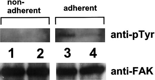 Fig. 6. Tyrosine phosphorylation of pp125FAK. / Nonadherent or adherent 293 cells stably expressing wild-type αIIbβ3 (lanes 1 and 3) or Tyr143HisαIIbβ3 (lanes 2 and 4) on fibrinogen were lysed in Triton X-100 buffer containing sodium vanadate. pp125FAK was immunoprecipitated with 1 μg rabbit polyclonal antibody specific for FAK. Precipitates were separated on 7.5% SDS-PAGE and transferred to a PVDF membrane. Phosphotyrosine was detected with monoclonal antibody 4G10. To monitor the loading of gel lanes, the blots were reprobed with anti-FAK.