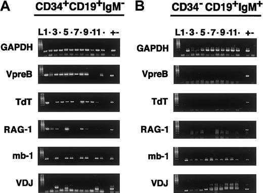 Fig. 2. Gene expression profiles in single cells from distinct B-lineage stages. / Surface CD34+CD19+IgM− (A) and CD34−CD19+IgM+ (B) sorted cells are analyzed for mRNA expression of the indicated genes after multiplex RT-PCR. In the left panel, the bands in each of the twelve tracks (numbers 1-12), aligned in the 6 electrophoresis gels, show correlated amplification of gene products from individual CD34+CD19+IgM− cells (ie, cell 1 is VpreB+, TdT+, RAG-1+, mb-1/CD79+, recombined V-D-JH−). The right panel shows electrophoresis of the gene products amplified from tubes containing titrated numbers of CD34−CD19+IgM+ B cells: tracks 1 to 6, one cell; tracks 7 to 9, 10 cells; tracks 10 to 12, 100 cells. Similarly processed positive controls (+) correspond to individual Nalm-6 pre-B leukemia single cells, whereas no cells are added in the negative controls (−). The identity of the amplified gene products is ascertained by direct sequencing of the cDNA in the excised bands and by molecular weight estimation (ladders). Note that the lower bands in the V-D-J gel in panel A correspond to primer artifacts and do not contain V-D-JH products, as determined by sequencing. L indicates ladder.