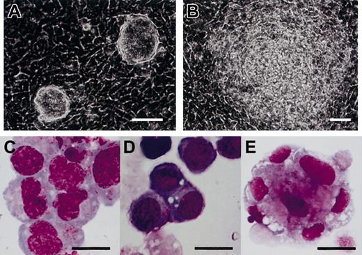 Fig. 2. Hematopoietic differentiation of TT2 ES cells on feeder cell layers of OP9. / (A-B) Phase-contrast micrographs of TT2 ES cell colonies on OP9 feeder cell layers on day 3 (A) and day 5 (B) are shown. (C-E) May-Giemsa staining of cytospin specimens of hematopoietic cells derived from TT2 ES cells. TT2 cells were cultured on OP9 feeder cell layer for 15 days in total, without addition of exogenous cytokines. Floating cells were applied to cytospin preparations and stained with May-Giemsa. Cells of myeloid (C), erythroid (D), and megakaryocytic (E) lineages are shown. Scale bars represent 50 μm (A-B); and 20 μm, (C-E).