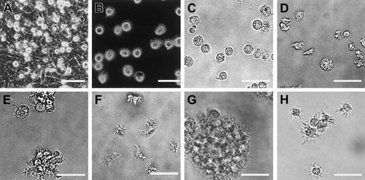Fig. 3. Morphology of ES cell–derived DCs. / ES cell–derived cells on day 8 (A), day 12 (B-C), day 17 (D-E), and day 27 (F) of differentiation culture are shown. Cells on day 24 were recovered and stimulated for 2 days with IL-4, TNF-α, plus agonistic anti-CD40 mAb (G), or with IL-4, TNF-α, plus LPS (H). Panels A and B are phase-contrast micrographs. Scale bars represent 20 μm.
