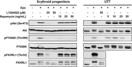 Fig. 2. Effect of LY294002 and rapamycin on phosphorylation. / LY294002 inhibits phosphorylation of Akt, P70S6K, and FKHRL1 proteins in human erythroid progenitors and UT7 cells whereas rapamycin inhibits only the mTOR/P70S6K pathway. Lysates were prepared from human erythroid progenitors or UT7 cells stimulated with Epo in the absence or presence of either LY294002 or rapamycin at different concentrations, and analyzed by Western blot with anti-pAkt (Ser473), anti-pP70S6K (Thr389), anti-pFKHRL1 (Thr32), anti-Akt, anti-P70S6K, and anti-FKHRL1 antibodies.