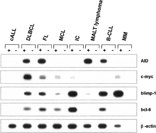 Fig. 3. Expression of AID mRNA in human non-Hodgkin lymphomas. / cDNA pools were prepared from cALL, DLBCL, FL, MCL, IC, MALT lymphoma, B-CLL, and MM. The cDNA of AID (nt 200-520), c-myc (nt 594-893), blimp-1 (nt 421-824), bcl-6 (nt 248-547), and β-actin (nt 391-660) was amplified by PCR. PCR products were separated by agarose gel electrophoresis and hybridized with an internal radiolabeled oligonucleotide. A representative autoradiograph with the PCR products of one individual tissue sample for each NHL entity is shown.