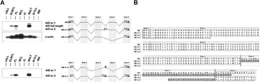 Fig. 4. Alternative splicing of AID mRNA in human non-Hodgkin lymphoma. / Full-length AID mRNA (nt 11-720) was amplified by PCR from cDNA pools of human NHL, and the PCR products were hybridized with an internal oligonucleotide (A, upper panel). AID splice variants sv1 and sv2 were amplified by half-nested PCR using a specific oligonucleotide (AID14) complementary to the neo-exon in intron 3 (A, lower panel). The primers used for the RT-PCR are indicated with their respective numbers. The amino acid sequence of the 4 different splice variants of the human AID gene is shown (B). The shaded boxes mark the amino acid residues aberrant to the full-length sequence; the asterisks indicate the deleted amino acid residues of the splice variants.