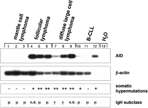 Fig. 6. Expression of AID mRNA, somatic hypermutation, and class switch recombination of the. / IgH gene in germinal center non-Hodgkin lymphoma.cDNA pools were synthesized from total RNA of MCL (n = 3), FL (n = 3), DLBCL (n = 3), and B-CLL (n = 3). AID (nt 328-520) and β-actin cDNA (nt 391-660) were amplified by PCR and hybridized with radiolabeled internal oligonucleotides. Recombined V(D)J segments of the IgH transcripts were amplified using a set of degenerate primers and were subsequently sequenced. Point mutations of less than 3% in comparison with the published sequences were regarded as somatic hypermutation negative (−), point mutations of more than 3% but less than 6% were regarded as somatic hypermutation positive (+), and point mutations of more than 6% were regarded as strong positive for somatic hypermutation (++). Immunoglobulin heavy-chain expression was determined by standard immunohistochemistry, and the constant region of the IgH locus is indicated. n.d. denotes nondetectable IgH gene expression.