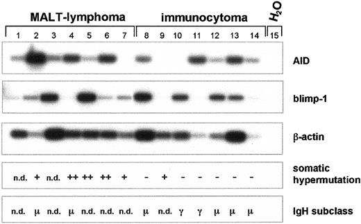 Fig. 7. Expression of AID mRNA, somatic hypermutation, and class switch recombination of the. / IgH gene in MALT lymphoma and immunocytoma. cDNA pools were synthesized from total RNA of MALT lymphomas (n = 7) and immunocytoma (n = 7). AID (nt 200-520), blimp-1 (421-824), and β-actin cDNA (nt 391-660) were amplified by PCR and hybridized with a radiolabeled internal oligonucleotide. Recombined V(D)J segments of the IgH transcripts were amplified using a set of degenerate oligonucleotides as primers and subsequently entirely sequenced. Point mutations of less than 3% in comparison to the published sequences are defined as somatic hypermutation negative (−), point mutations of more than 3% but less than 6% are defined as somatic hypermutation positive (+), and point mutations of more than 6% are defined as strong positive for somatic hypermutation (++). Immunoglobulin heavy-chain expression was determined by standard immunohistochemistry, and the constant region of the IgH locus is indicated. n.d. denotes nondetectable IgH gene expression.