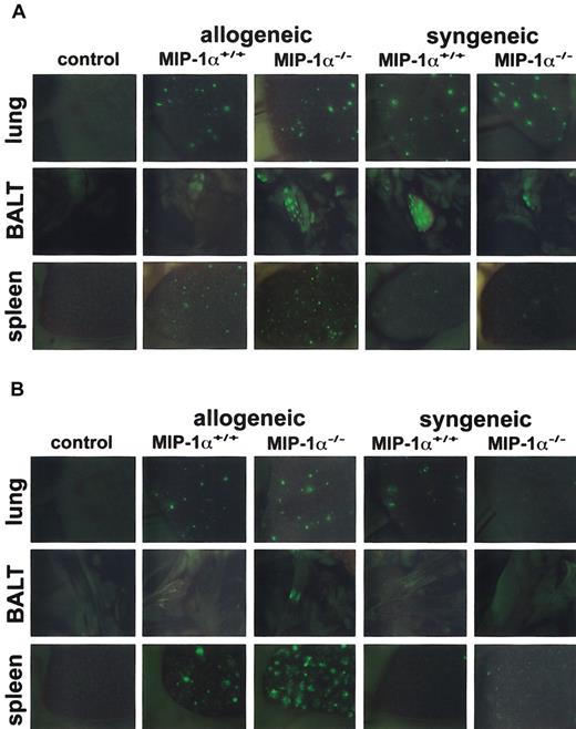 Fig. 3. Recipients of GFP-Tg MIP-1α−/− spleen cells exhibit increased migration into the lung, BALT, and spleen on day 3 after BMT. / Lethally irradiated B10.BR (allogeneic) or C57BL/6 (syngeneic) mice received C57BL/6 BM and either GFP-Tg MIP-1α+/+ or GFP-Tg MIP-1α−/− spleen cells. Shown are in vivo images (1.9-second exposures) of lung, BALT, and spleen captured at day 1 (Figure 3A) and day 3 (Figure 3B) after BMT with a color camera mounted on a stereomicroscope with a GFP filter (× 10.0 zoom factor and × 0.63 transfer lens). “Control” indicates recipient mice receiving allogeneic BM only; images are similar to those of mice receiving syngeneic BM only. Tissues from 1 mouse (of 3 mice) per group per time point are shown.
